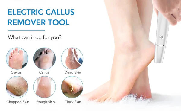 🔥Electric callus remover for feet Secondary image