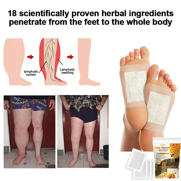 Bee Venom Lymphatic Drainage & Slimming Foot Patches 🌿👣 (HM Official)